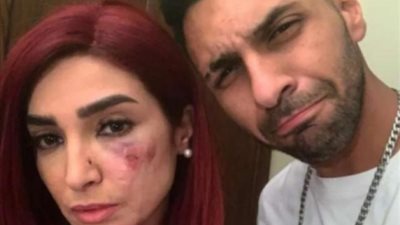 7 غرز في وجهها.. تطورات الحالة الصحية لـ روجينا بعد إصابتها من باسم سمرة