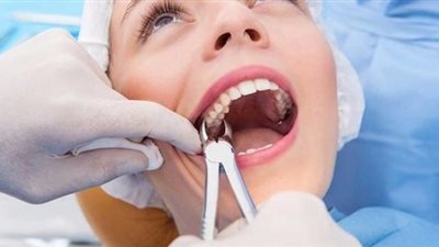 «الإفتاء» توضح حكم خلع الأسنان في نهار رمضان