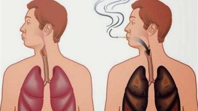 5 مشروبات لتنظيف الرئة.. تعرف عليها