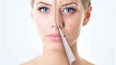 لا داعي لمراكز التجميل.. خلطات طبيعية لعلاج مشاكل البشرة