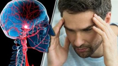 احمى نفسك من الإصابة بالسكتة الدماغية.. بهذه الطريقة السريعة