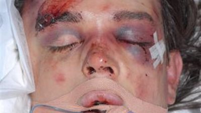 السجن مدي الحياة علي شاب ضرب جاره ”المعاق” حتي الموت بسبب ”نباح الكلب”