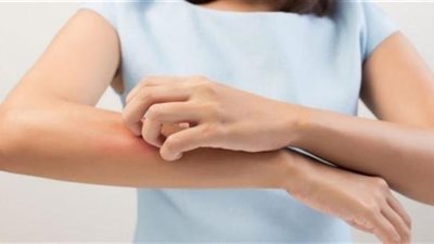 هل الطفح الجلدي من أعراض فيروس كورونا؟.. إليك الإجابة
