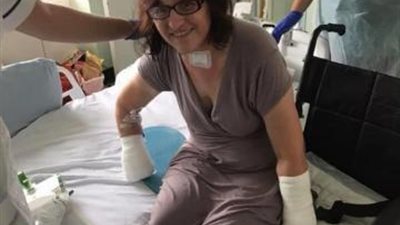 أطباء يقطعون أيدي وأرجل سيدة بعد شفائها من فيروس كورونا