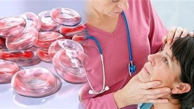 أهم أعراض ومخاطر نقص الحديد في الجسم