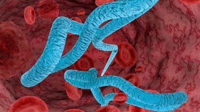 فيروس الإيبولا.. كيف يصاب الأفراد بـ«قاتل البشر»؟