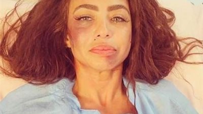 تطورات الحالة الصحية لـ دوللى شاهين بعد الاعتداء عليها بالضرب من قبل مجهولين