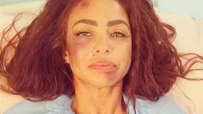 طلع فنكوش.. القصة الكاملة للاعتداء على دوللى شاهين بالضرب