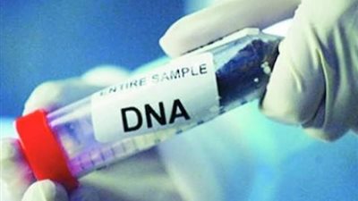 لها شروط.. تعرف على الحكم الشرعي لاستخدام البصمة الوراثية