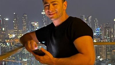 شاهد.. حمادة هلال يكشف عن تعرضه للإصابة في الوجه