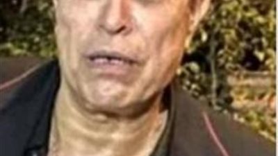 بالصور.. حقيقة ظهور علمات الشيخوخة على حكيم