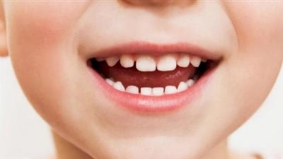 تعرف على السبب الرئيسي لرائحة الفم الكريهة