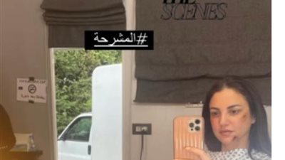 درة تكشف كواليس ”المشرحة” من وراء الكواليس