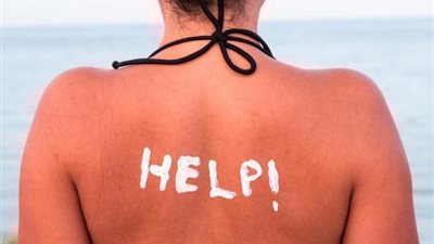 أبرزها اللبن والشاي.. روشتة علاجية سريعة لعلاج حروق الشمس