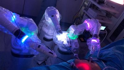 بالصور .. تفاصيل 25 جراحة روبوتية ناجحة بمستشفى عين شمس التخصصي