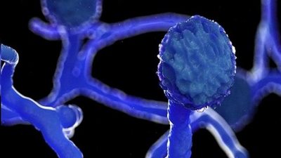 هل انتشرت سلالة الفطر الأسود في مصر بين مصابى كورونا؟