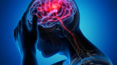 هذه أبرز العوامل التي تتسبب في الجلطات الدموية