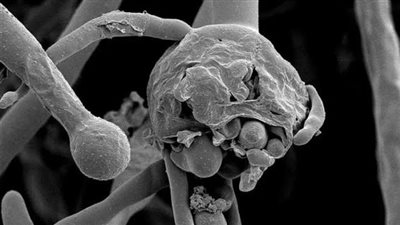 «الفطر الأسود» يتفشي بطريقة مرعبة فى دولة عربية كبري