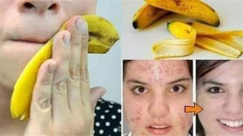 قشر الموز