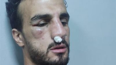 تعرف على التشخيص المبدئي لإصابة مدافع الاتحاد بعد تدخل أحمد فتحي