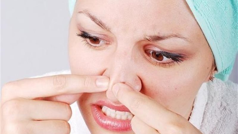 إزالة الرؤوس السوداء