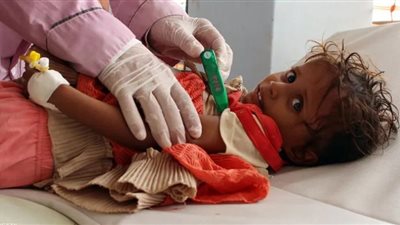 دولة عربية تُعلن تسجيل أول وفاة بالكوليرا