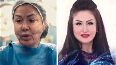 وفاء سالم تخضع لعملية تجميل جديدة