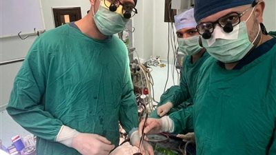 بالصور..فريق طبى بجامعة أسيوط ينجح فى إنقاذ  حياة سيدة أربعينية باستئصال ورم ضخم من القلب