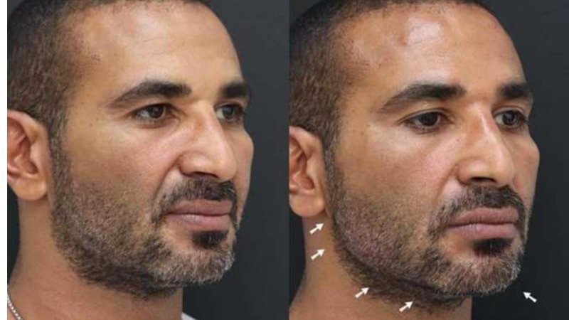 سعد