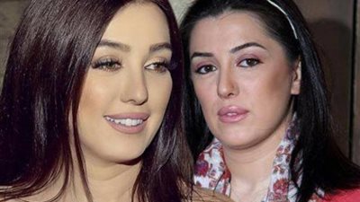 طبيبة التجميل الخاصة بكندة علوش تكشف عدد عمليات التجميل التي خضعت لها