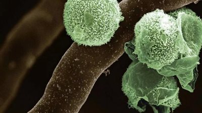 بعد ظهور أول حالة .. معلومات مثيرة عن الفطر الأخضر