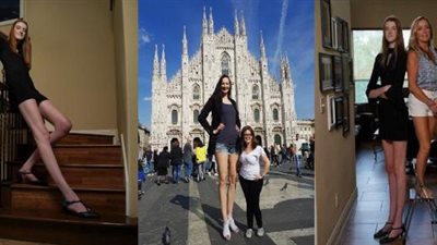 بعد تحطيمها رقمين قياسيين في جينيس.. القصة الكاملة لـ صاحبة أطول ساق في العالم