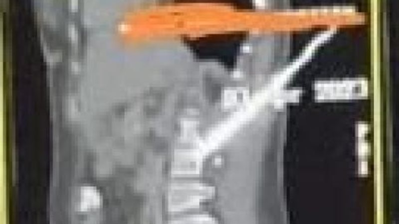 الموجز