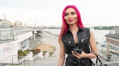 تريند السوشيال ميديا.. كل ما تريد معرفته عن حكاية صاحبة أكبر خدود في العالم