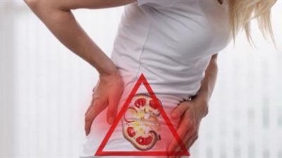 ما هى أعراض حصوات الكلى وطرق العلاج منها؟.. إليك الإجابة