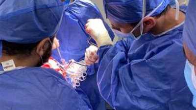 بالصور .. فريق طبي بمستشفى بدر الجامعي ينجح بإجراء جراحة لاستئصال ورم في المخ في ٣ ساعات