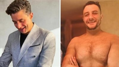 أحمد الفيشاوي يكشف تفاصيل إزالة التاتوهات من جسده