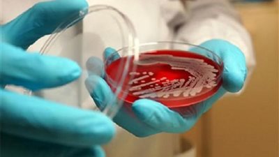 «مرسا».. حقائق صادمة عن المرض الذى قتل 11 ألف شخص وسر تشابهه مع كورونا