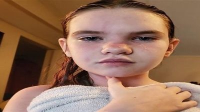 هذه الفتاة إذا ”استحمت” أو غسلت وجهها ستموت