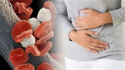 جمعية سرطان الدم تدق جرس الإنذار..  هذه الأعراض دليل على الإصابة بالمرض