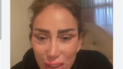 جه يكحلها شوهها.. ريهام سعيد تكشف كواليس عملية التجميل الفاشلة: بقيت شيطان