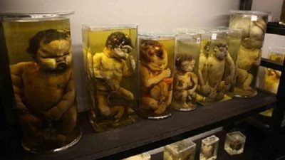 عمره 100 عام.. ويضم 1300 عينة لحالات مرضية نادرة.. حقائق مثيرة عن متحف الأجنة المشوهة