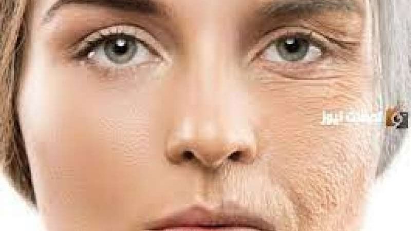 علاج تجاعيد الوجه