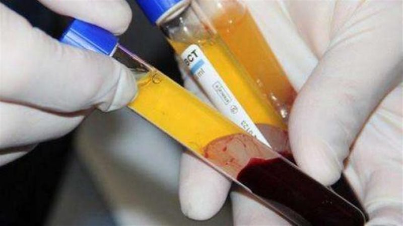 العلاج بالبلازما