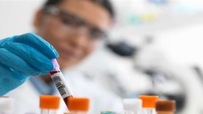 تجارب سريرية في بريطانيا علي تحليل دم جديد قد يكتشف أنواع من مرض السرطان قبل ظهور أعراضها