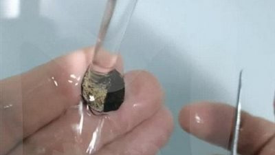 ظلت 50 عاماً داخل أنفه.. جراحة عاجلة لاستخراج عملة معدنية من وجه رجل روسي