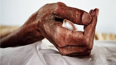 ننشر قائمة بعناوين مراكز الفحص والمشورة لمرضى الإيدز فى مصر