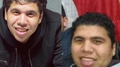 عمر كمال ينشر صورته ”أيام الكحرتة”: بلاش سخرية من شكلي