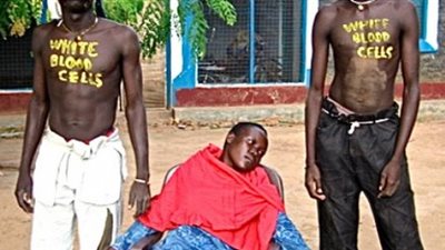 حقيقة إصابة 46 ألف سوداني بمرض الإيذر