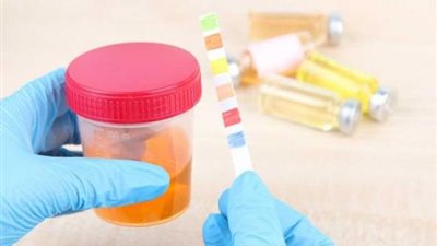 مستشفيات الصحة تعتمد  نوع جديد من ”تحليل البول” للكشف المبكر  عن سرطان المثانة